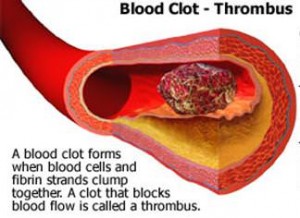 Blood Clotting